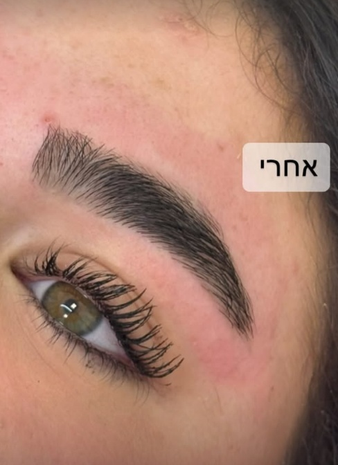 אחרי
